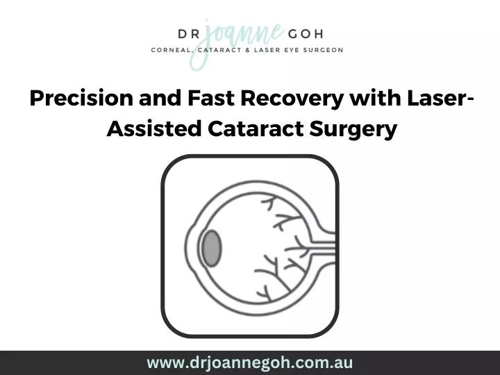 precision and fast recovery with laser assisted