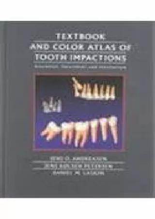 get [PDF] Download Textbook and Color Atlas of Tooth Impactions: Diagnosis, Treatment, Prevention