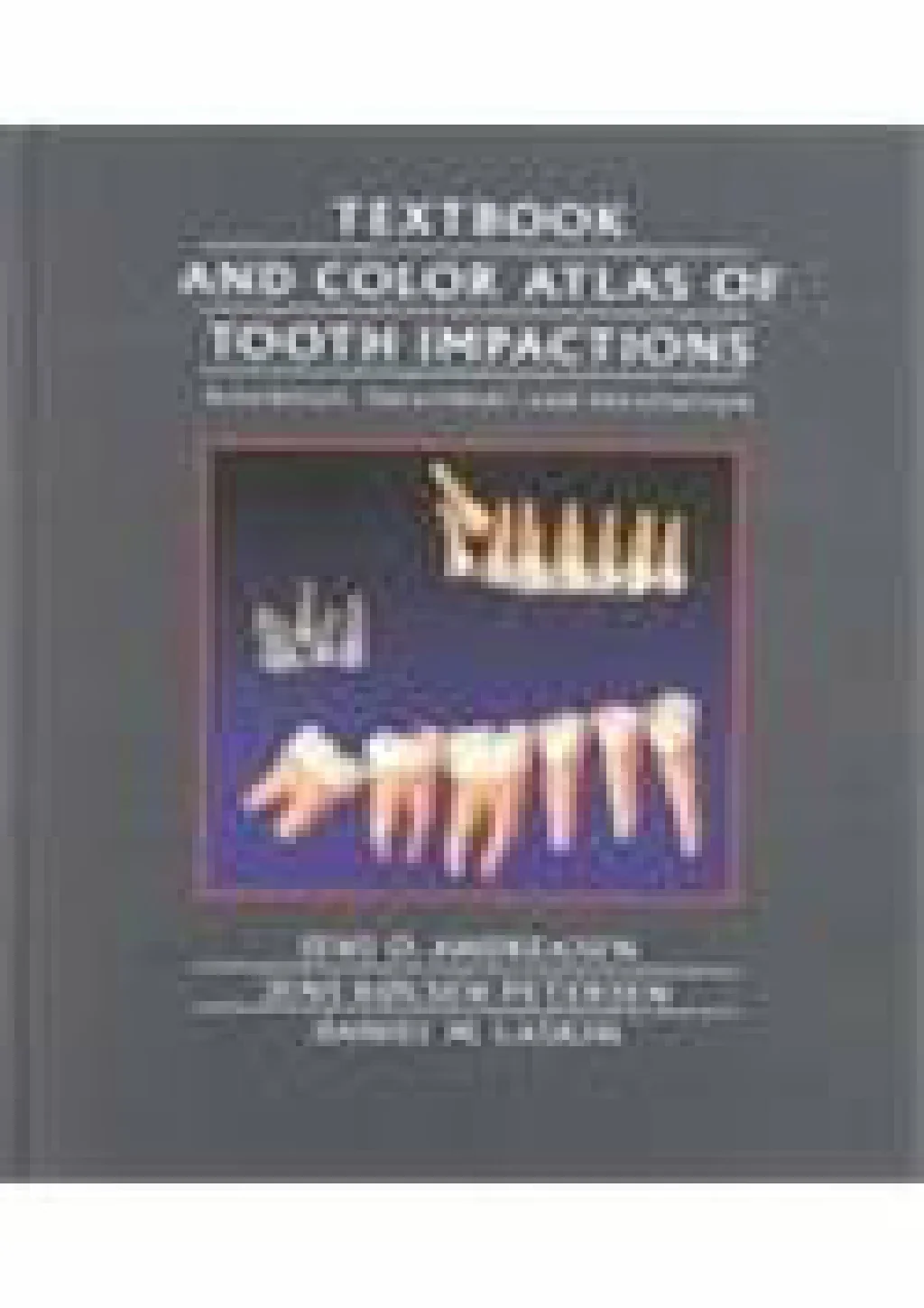 PPT - get [PDF] Download Textbook and Color Atlas of Tooth Impactions ...
