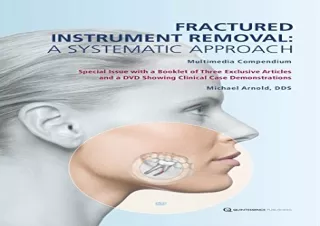 PDF Fractured Instrument Removal: A Systematic Approach Free