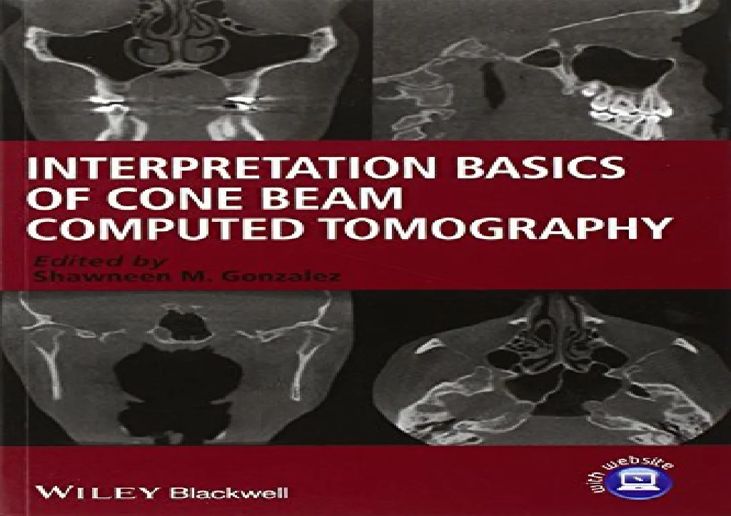 PPT - PDF Interpretation Basics of Cone Beam Computed Tomography Free ...