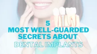 5 Most well- guarded secrets about dental implants