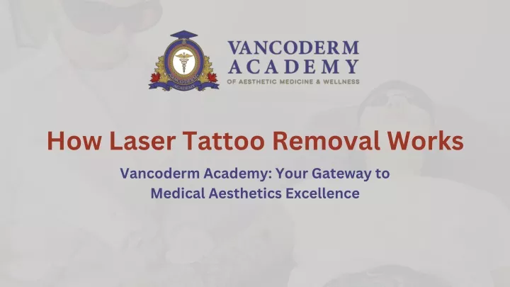 how laser tattoo removal works