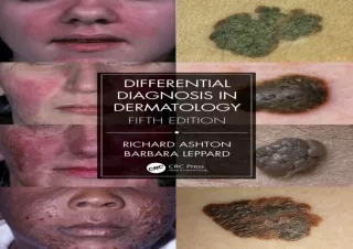 EBOOK READ Differential Diagnosis in Dermatology