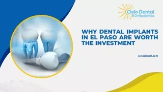 Why Dental Implants in El Paso Are Worth The Investment