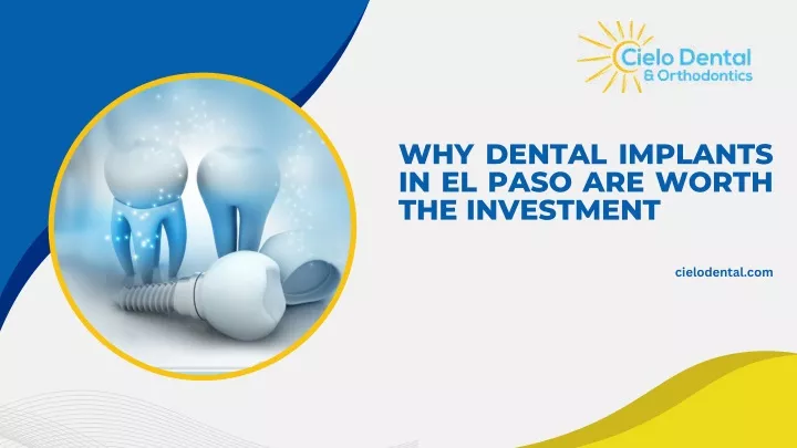 why dental implants in el paso are worth