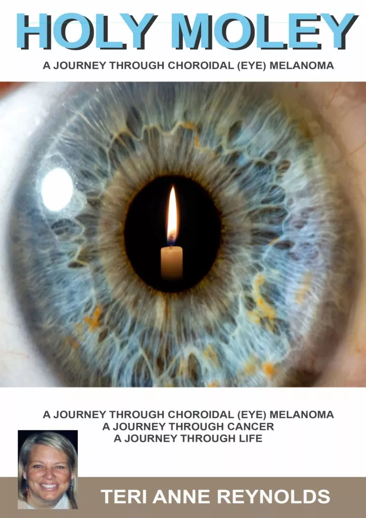 holy moley a journey through choroidal