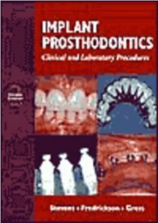 READ [PDF] Implant Prosthodontics: Clinical and Laboratory Procedures epub