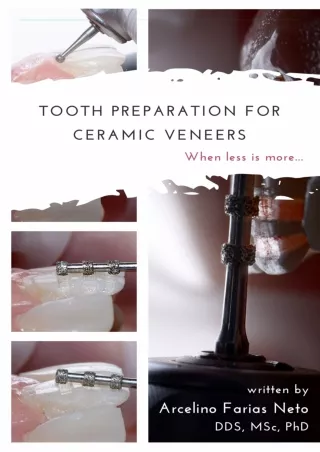 [PDF] DOWNLOAD EBOOK Tooth preparation for ceramic veneers: When less is more...
