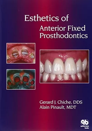 [PDF READ ONLINE] Esthetics of Anterior Fixed Prosthodontics