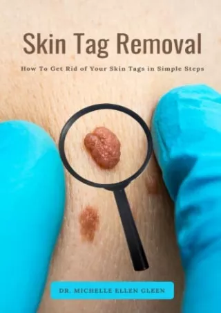 [READ DOWNLOAD] Skin Tag Removal: How To Get Rid of Your Skin Tags in Simple Steps