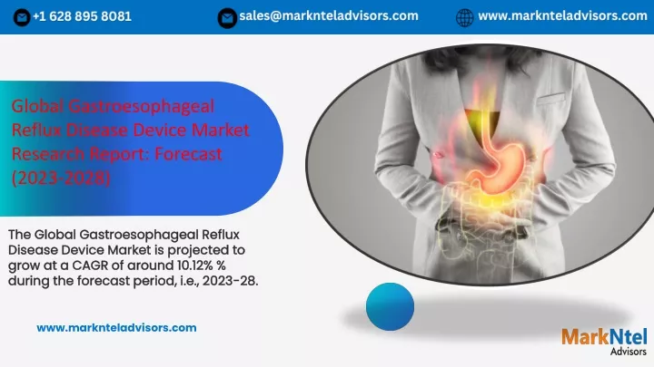 global gastroesophageal reflux disease device