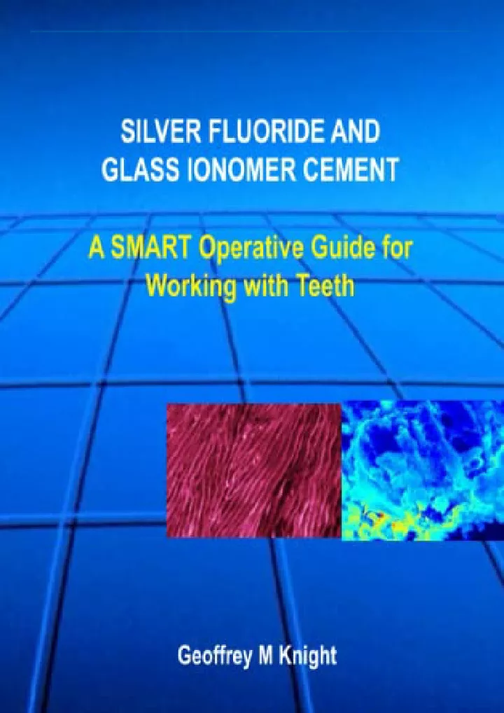 silver fluoride and glass ionomer a smart