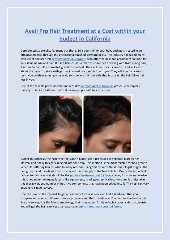 avail prp hair treatment at a cost within your