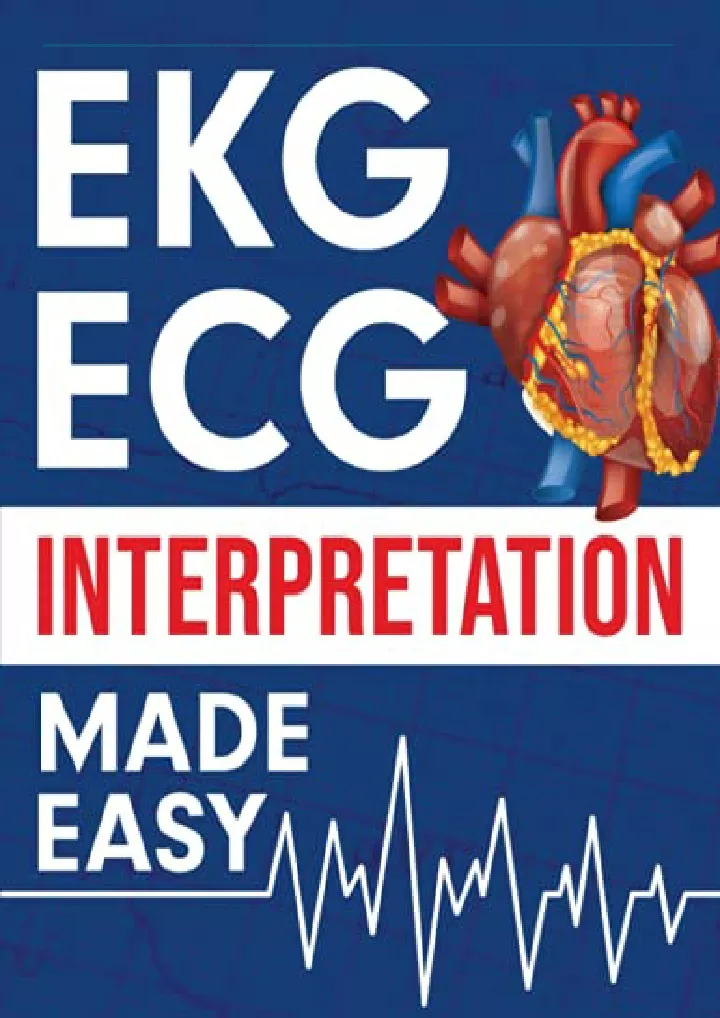 ekg ecg interpretation made easy an illustrated