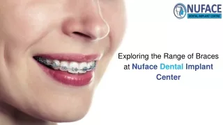 Types of Braces : Nuface Dental Implant Center