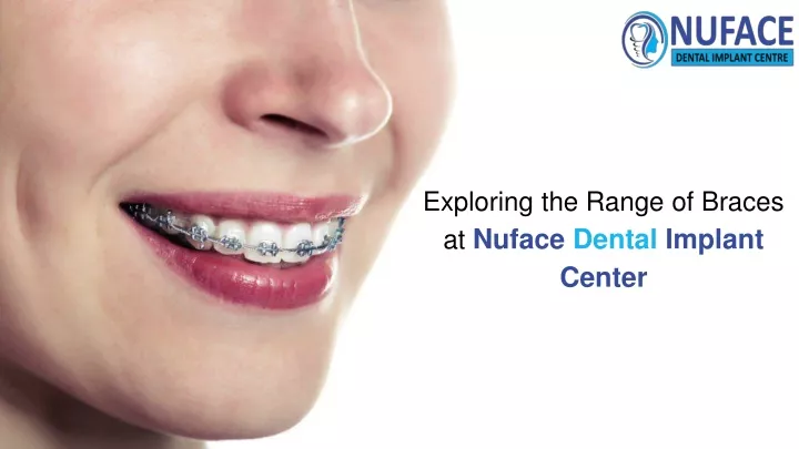 exploring the range of braces at nuface dental