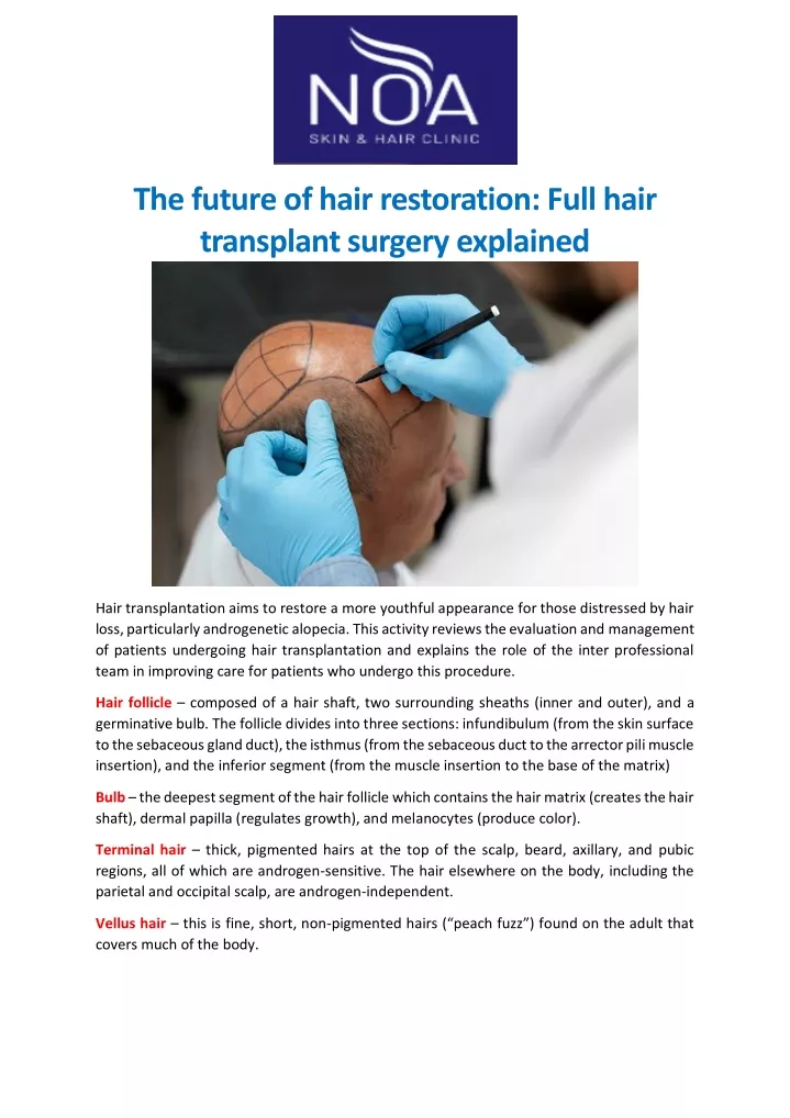 the future of hair restoration full hair
