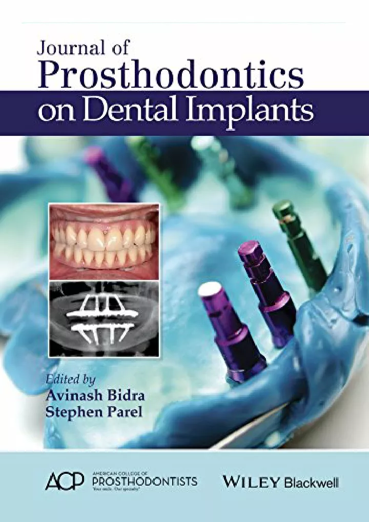 journal of prosthodontics on dental implants