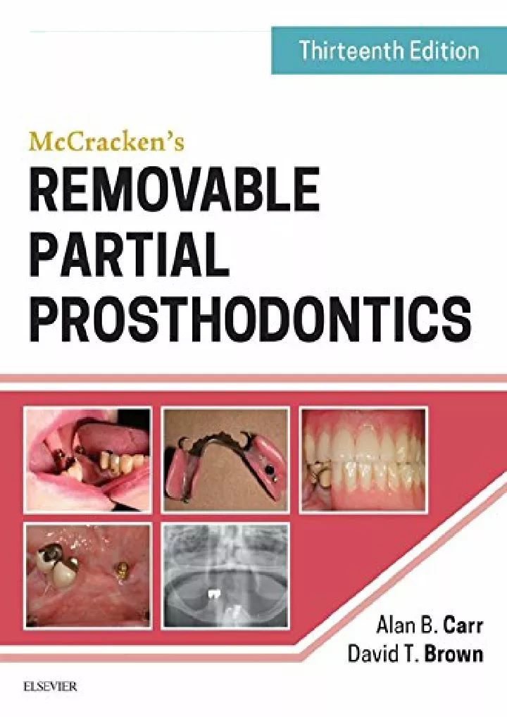 mccracken s removable partial prosthodontics
