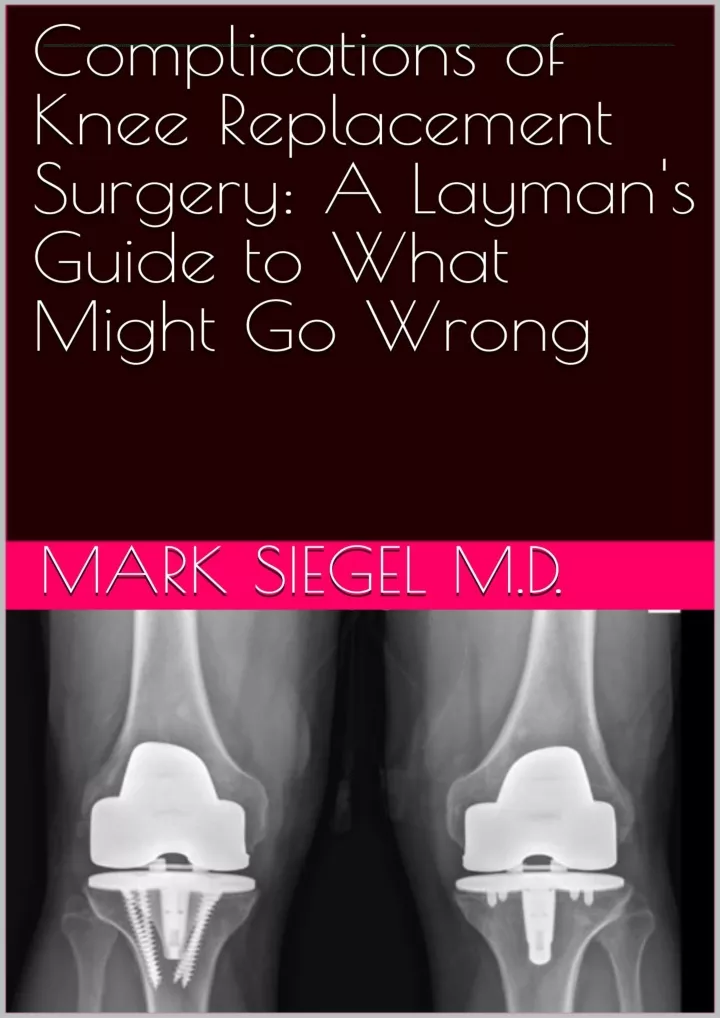 PPT - PDF_ Complications of Knee Replacement Surgery: A Layman's Guide ...