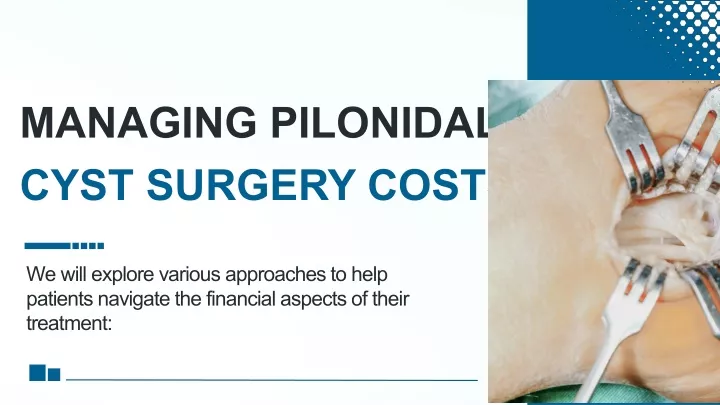 managing pilonidal cyst surgery costs