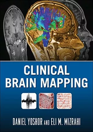 READ [PDF] Clinical Brain Mapping