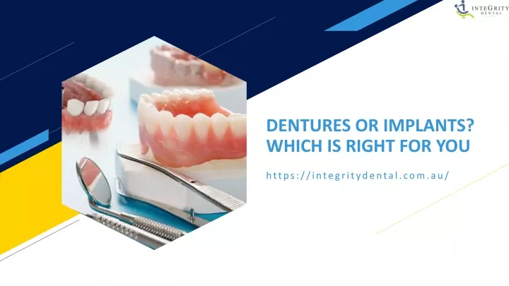 dentures or implants which is right for you