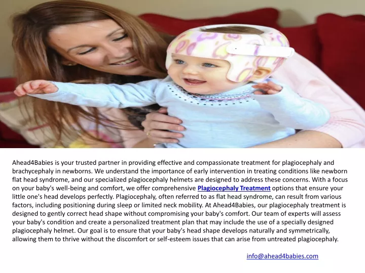 Plagiocephaly treatment hot sale uk