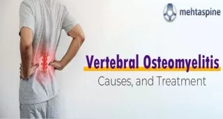 Vertebral Osteomyelitis: Causes, Treatment, and Prevention