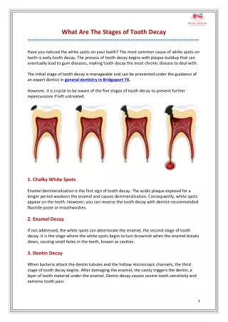 what are the stages of tooth decay