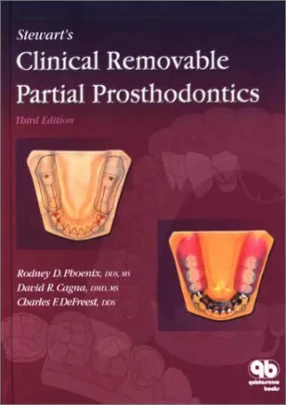 READ [PDF] Stewart's Clinical Removable Partial Prosthodontics ebooks