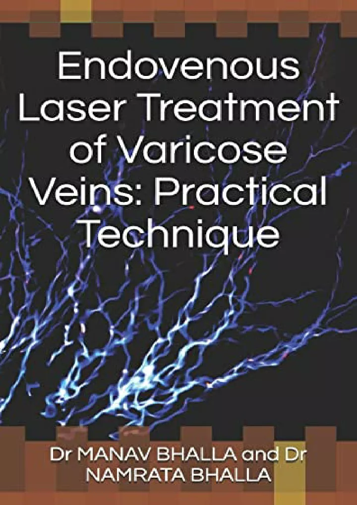 endovenous laser treatment of varicose veins