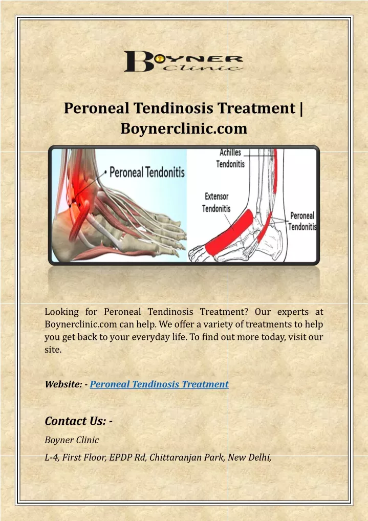 peroneal tendinosis treatment boynerclinic com