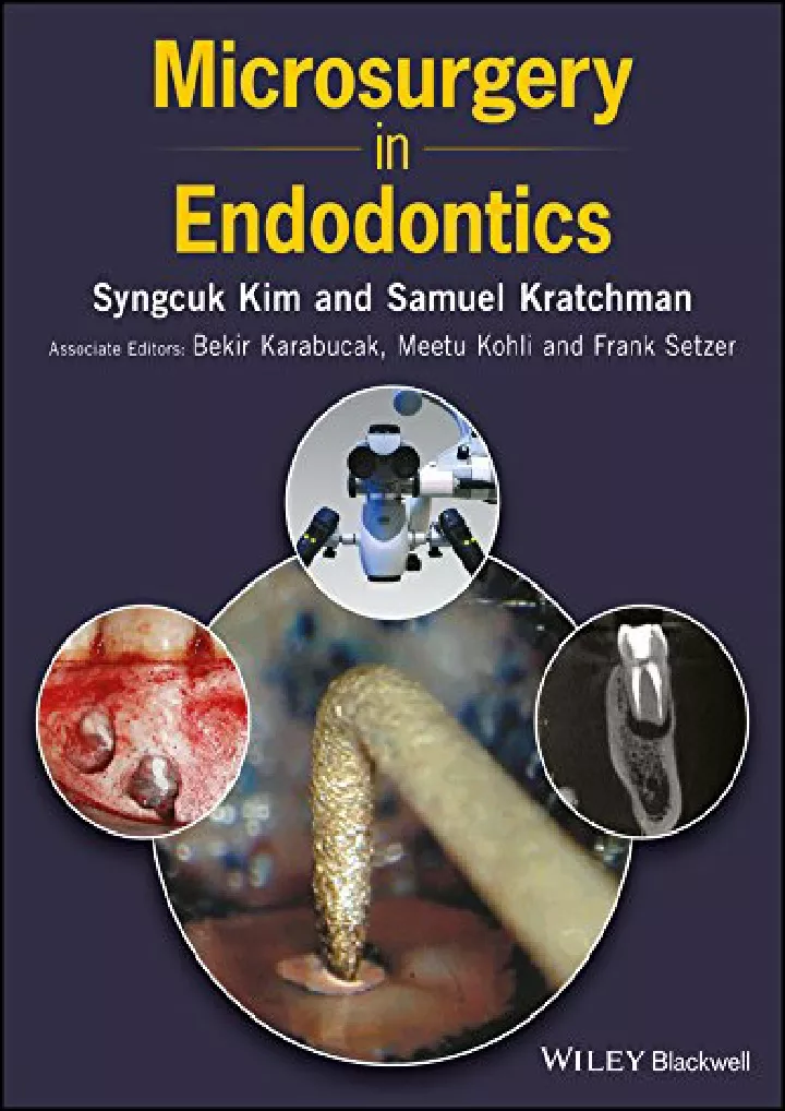 PPT - [PDF READ ONLINE] Microsurgery In Endodontics PowerPoint ...