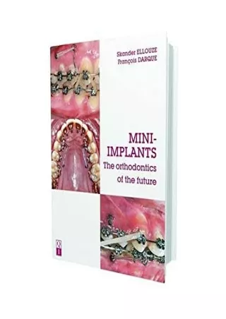 get [PDF] Download MINI-IMPLANTS: The Orthodontics of the Future
