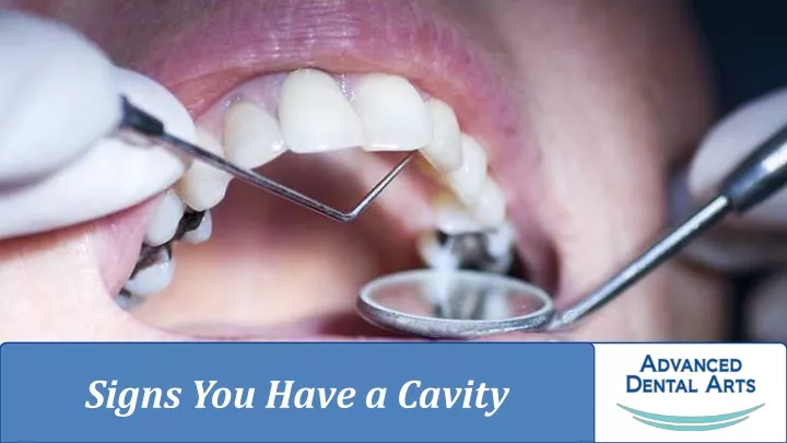 signs you have a cavity