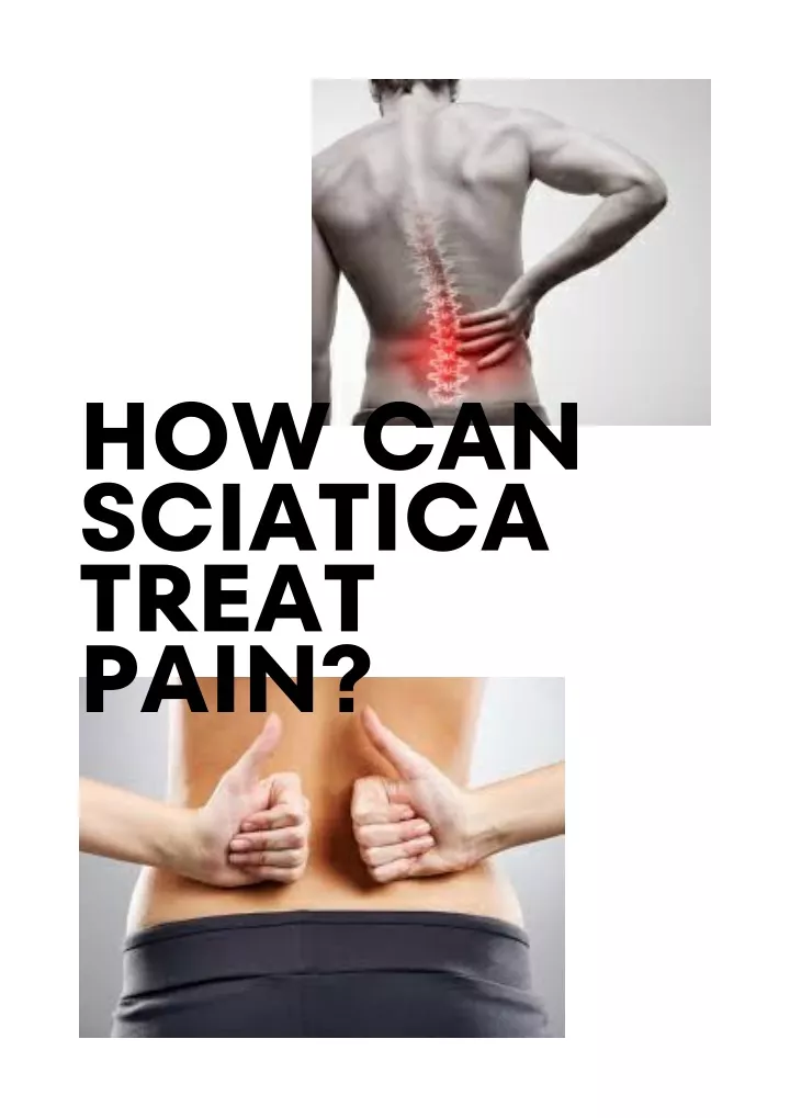 how can sciatica treat pain