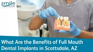 The Benefits Of Full Mouth Dental Implants