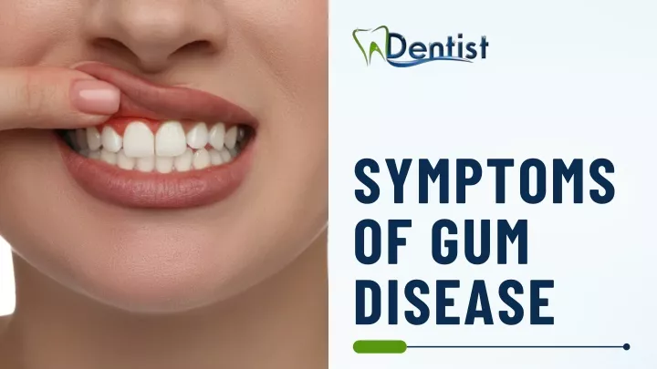 symptoms of gum disease