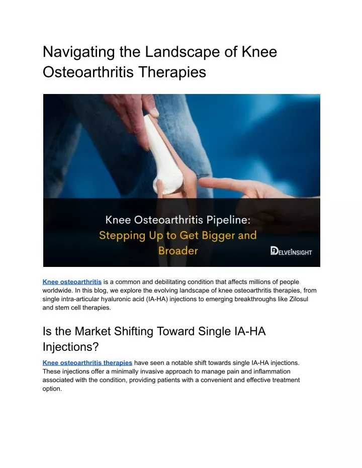 navigating the landscape of knee osteoarthritis