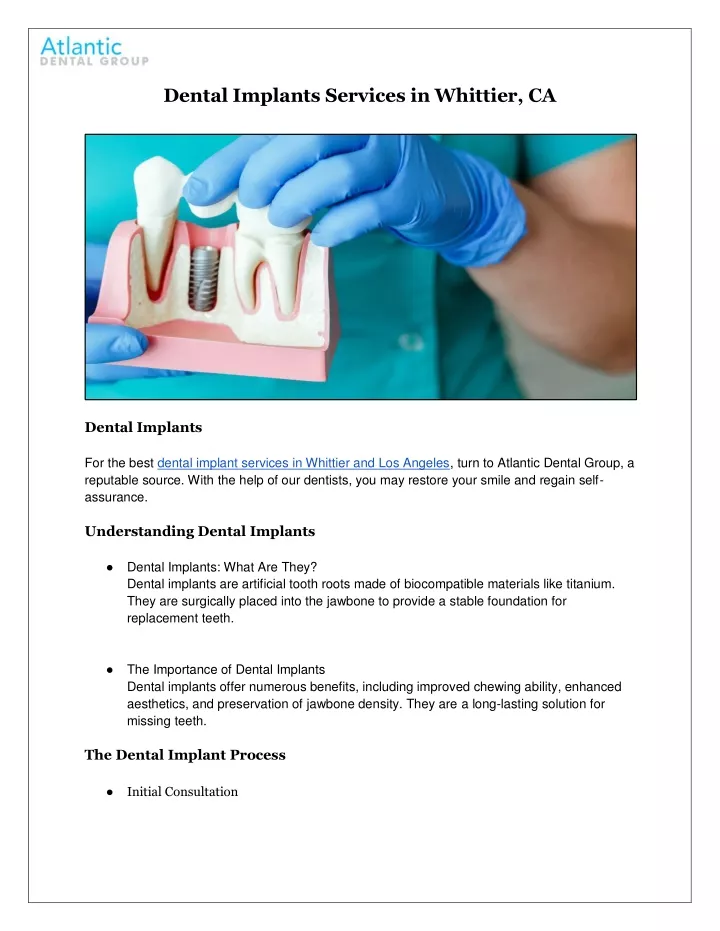 dental implants services in whittier ca
