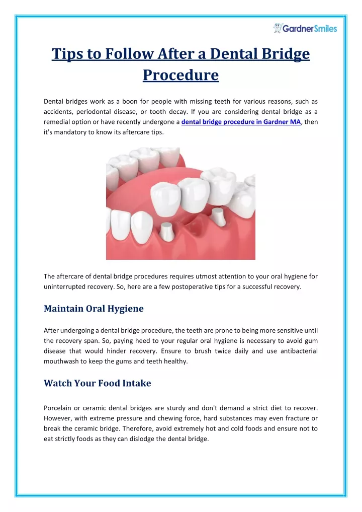 tips to follow after a dental bridge procedure