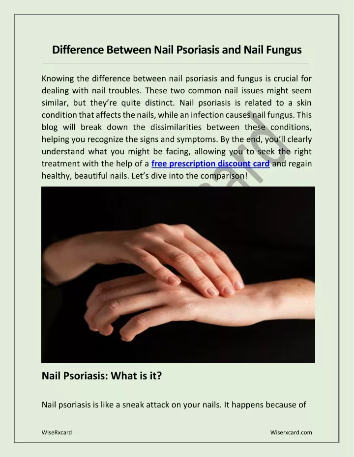 difference between nail psoriasis and nail fungus