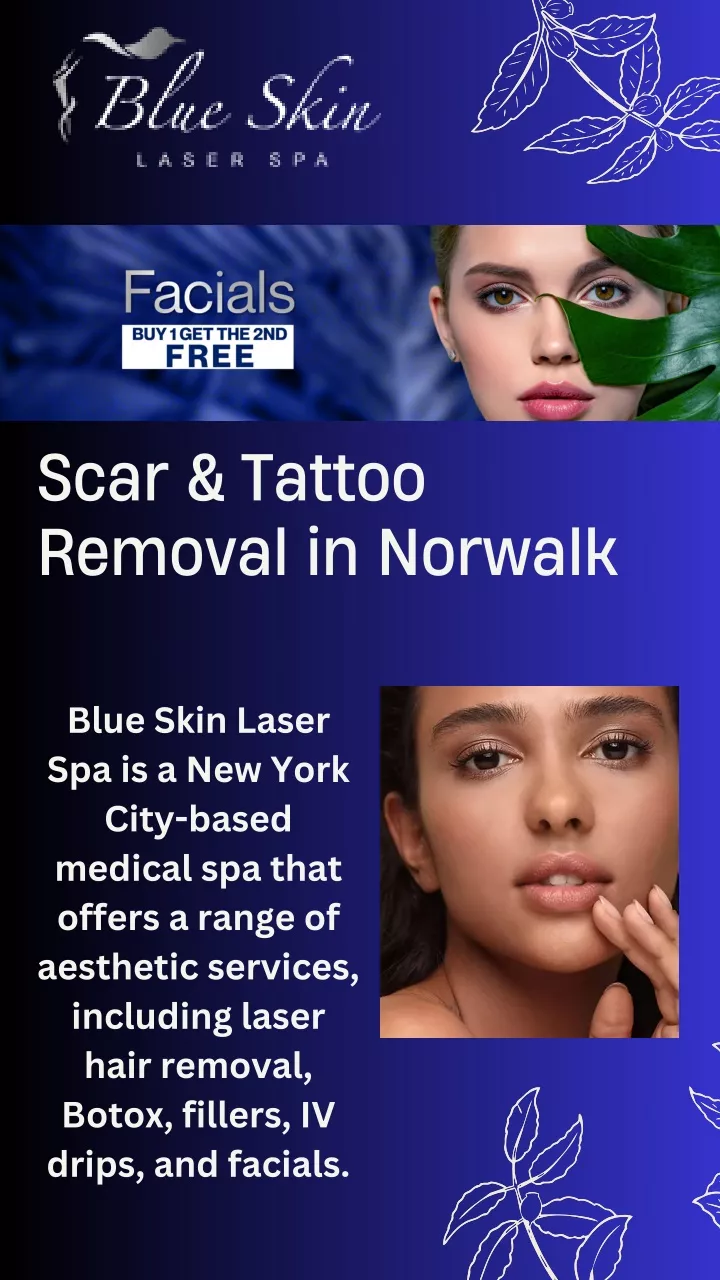 scar tattoo removal in norwalk