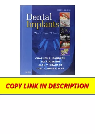 PDF read online Dental Implants The Art and Science full