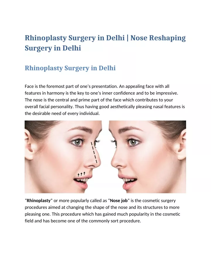 rhinoplasty surgery in delhi nose reshaping