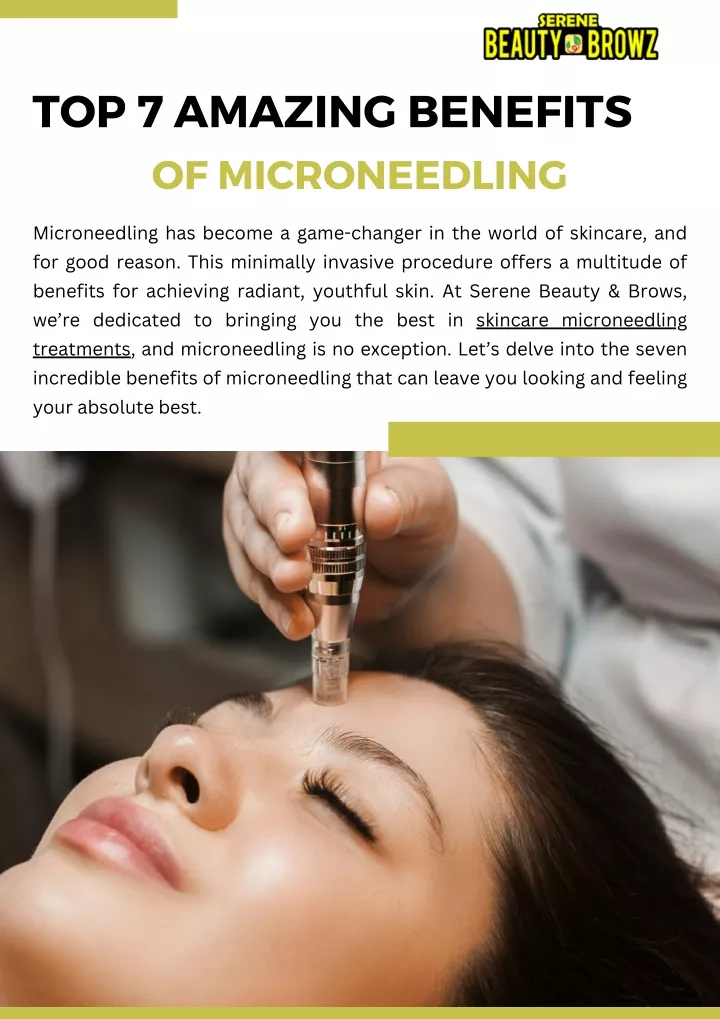 top 7 amazing benefits of microneedling