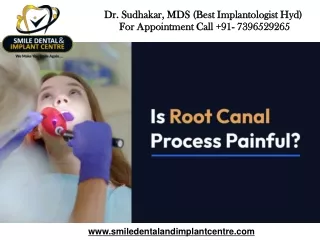 Painless Root Canal Treatment in AS Rao Nagar, Ecil, Hyderabad