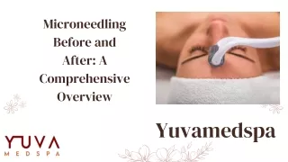 Microneedling Before and After A Comprehensive Overview